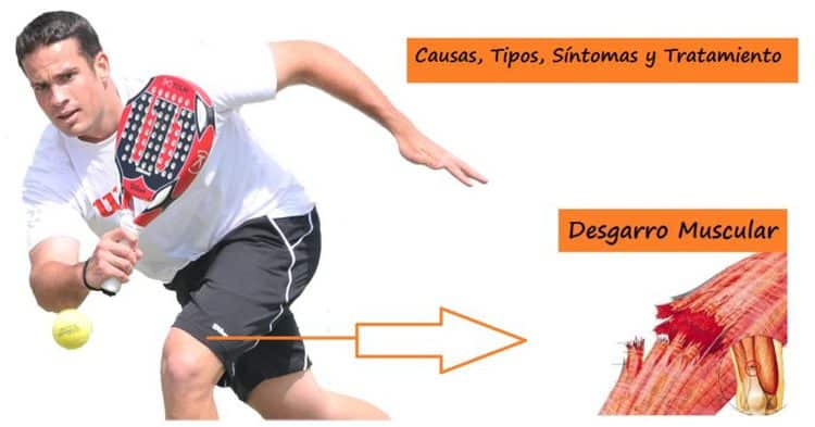 DESGARRO muscular ¡Causas, tipos, síntomas y TRATAMIENTO!