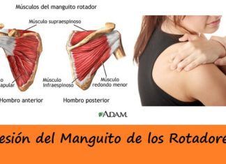 Lesión del MANGUITO de los ROTADORES 【Cuida tu hombro】 Manguito de los Rotadores