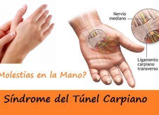 ¿Dolor en muñeca? Podría ser Síndrome del Túnel Carpiano Síndrome del Túnel Carpiano