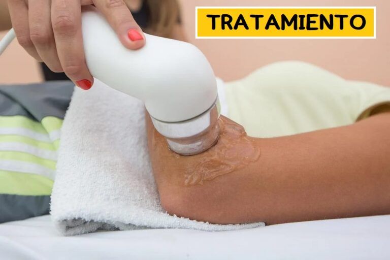 🎾 Prevención y Tratamiento de Esguinces de Tobillo: Claves para Evitar Lesiones y Volver más Fuerte a la Pista