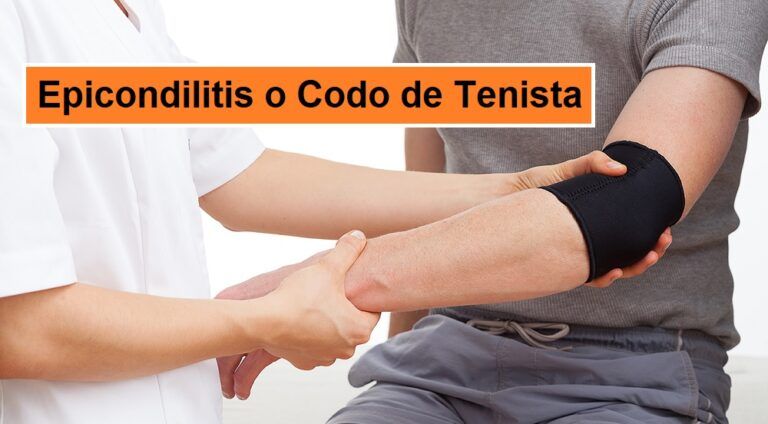 EPICONDILITIS o codo de tenista [Causas, Síntomas y Tratamiento]